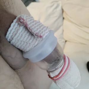 side view of flaccid hanging after 12 sets of hanging (March 29, 2010).webp
