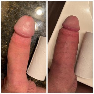 Comparison